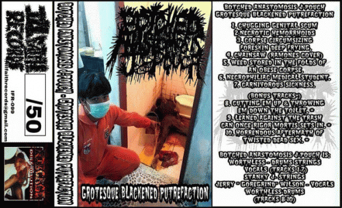Botched Anastomosis J-Pouch : Grotesque Blackened Putrefaction